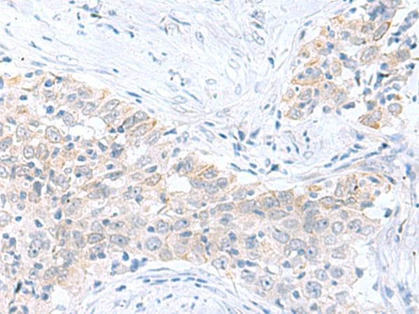 Polyclonal Rabbit anti-Human PDE6D / PDE6 Delta Antibody (IHC)