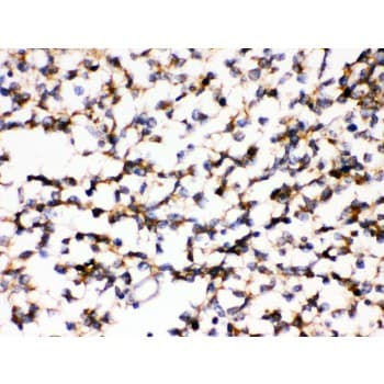 Polyclonal Rabbit anti-Human KCNIP2 / KCHIP2 Antibody (aa78-112, IHC, WB)