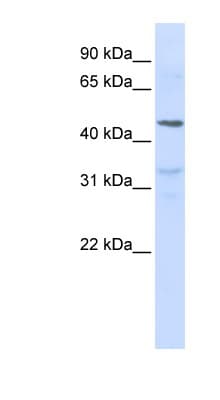 CRF2-12 / IL28RA Antibody (aa72-121)