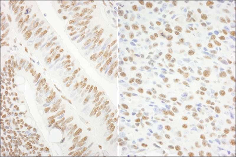 Polyclonal Rabbit anti-Human KHSRP / FBP2 Antibody (aa100-150, IHC, WB)