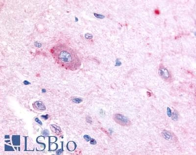 PathPlus™ Polyclonal Rabbit anti-Human RORB / ROR Beta Antibody (Ligand-binding Domain, IHC)