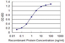 MAGI2 / AIP-1 Antibody (clone 6F5)