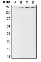 SCN4A / Nav1.4 Antibody (Internal)