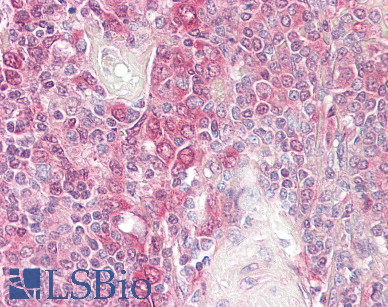 IHC-plus™ BID Antibody