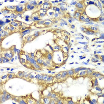 AK2 / Adenylate Kinase 2 Antibody