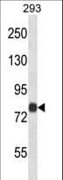 ACSL4 / FACL4 Antibody (aa28-56)