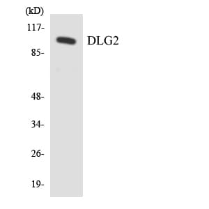 DLG2 / PSD93 Antibody (aa588-637)
