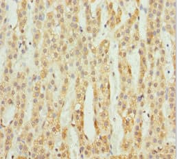 ACSL6 Antibody