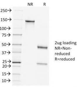 CLTC / Clathrin Heavy Chain Antibody (clone CLTC/1431)