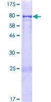 Human CCDC65 Protein (Recombinant GST)