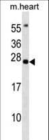 BCL7B Antibody (aa137-164)