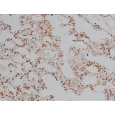 MAPT / Tau Antibody (phospho-Thr231)