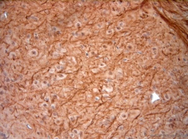 NEFH / NF-H Antibody (aa150-200)