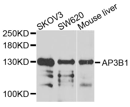 AP3B1 Antibody (AP)