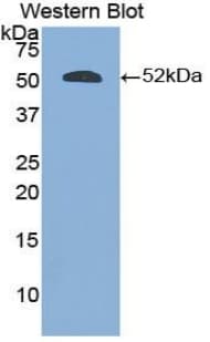 EPOR / EPO Receptor Antibody (aa33-210, APC)