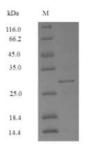 Mercurialis annua Mer a 1 Protein (Recombinant 6His-SUMO, N-terminus)