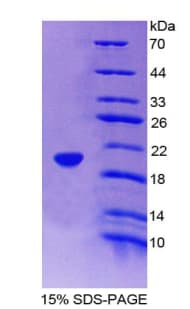 Rat FABP9 / Lipid-Binding Protein (Recombinant His-T7)