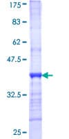 Human CPS1 Protein (Recombinant GST, N-terminus)