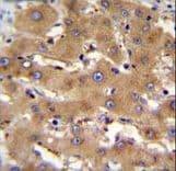Polyclonal Rabbit anti-Human PHF12 Antibody (aa831-859, IHC, WB)