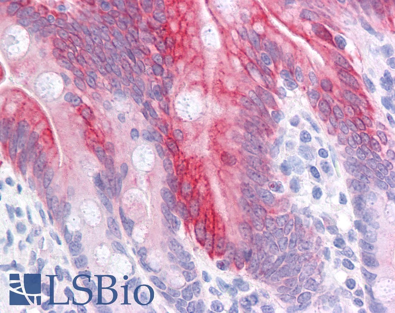 PathPlus™ KRT20 / CK20 / Cytokeratin 20 Antibody (clone 2G3-1C8)