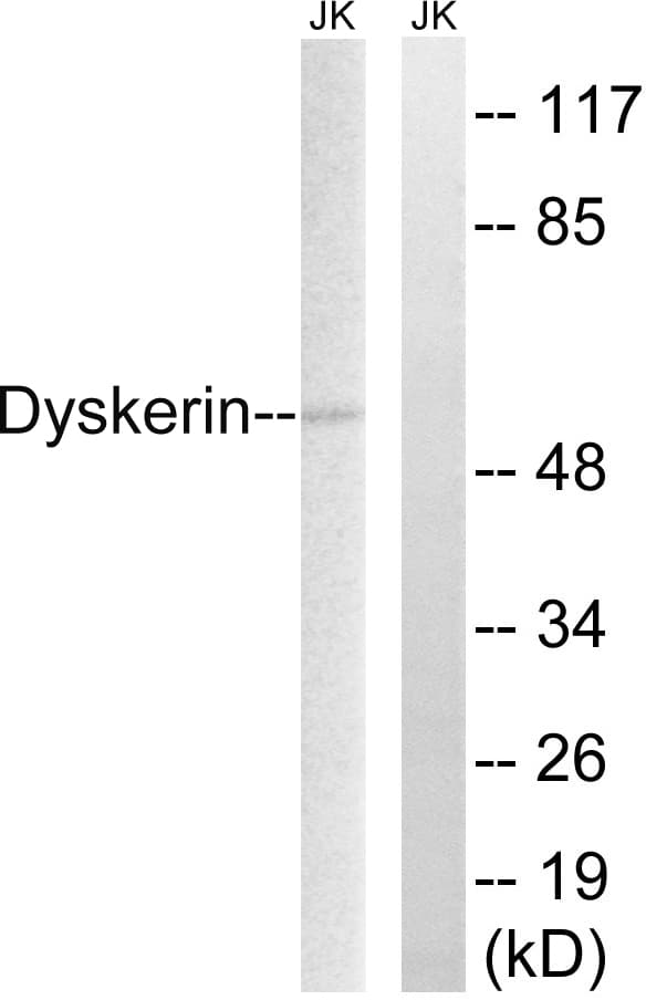 Polyclonal Rabbit anti-Human DKC1 / Dyskerin Antibody (aa171-220, IF, WB)