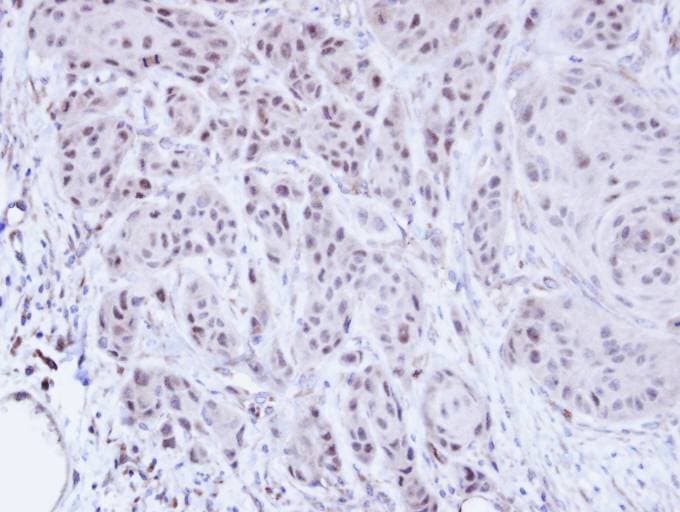 SCMH1 Antibody (aa29-285)