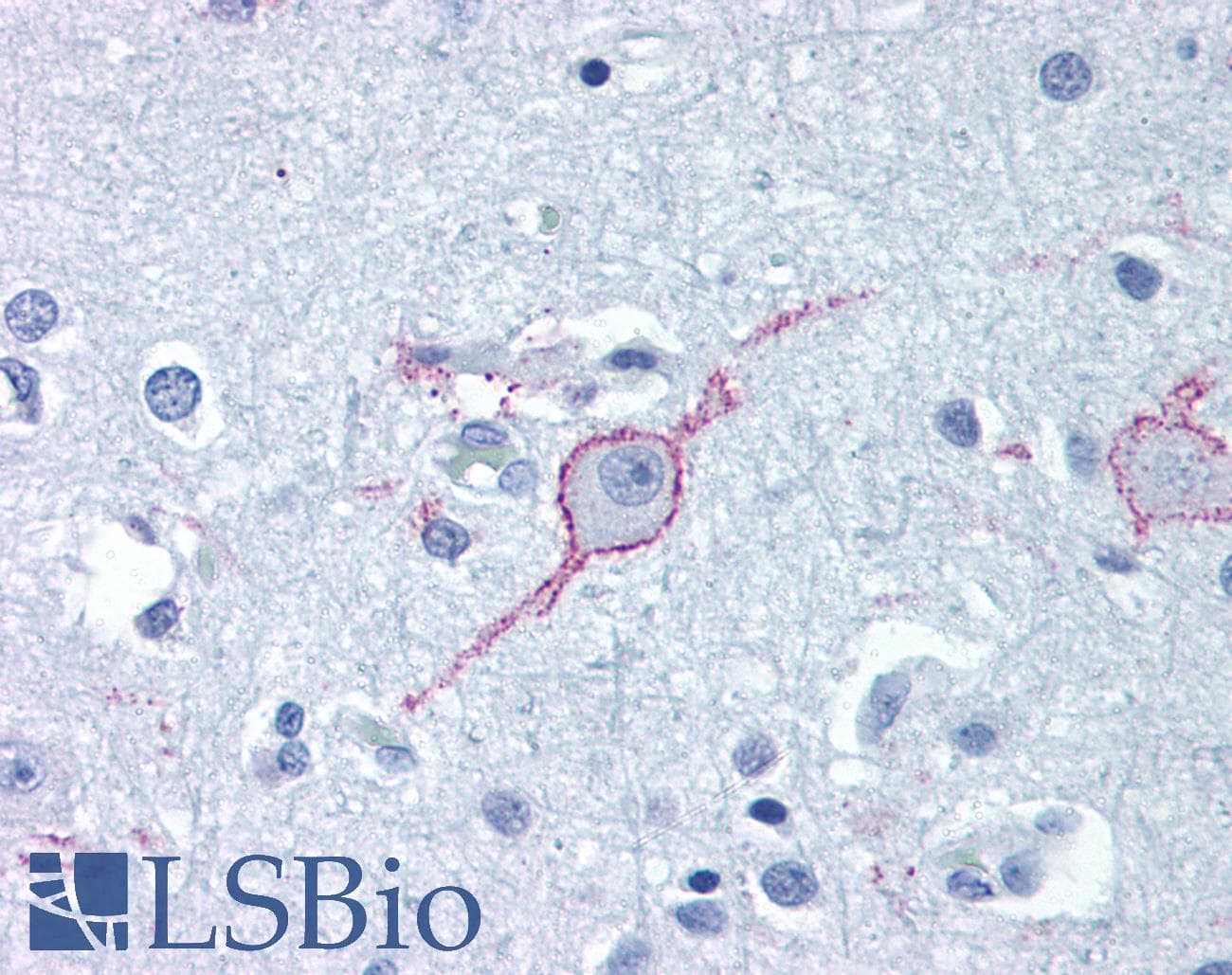 IHC-plus™ Polyclonal Rabbit anti-Human GALR3 / Galanin Receptor 3 Antibody (Extracellular Domain, IHC)