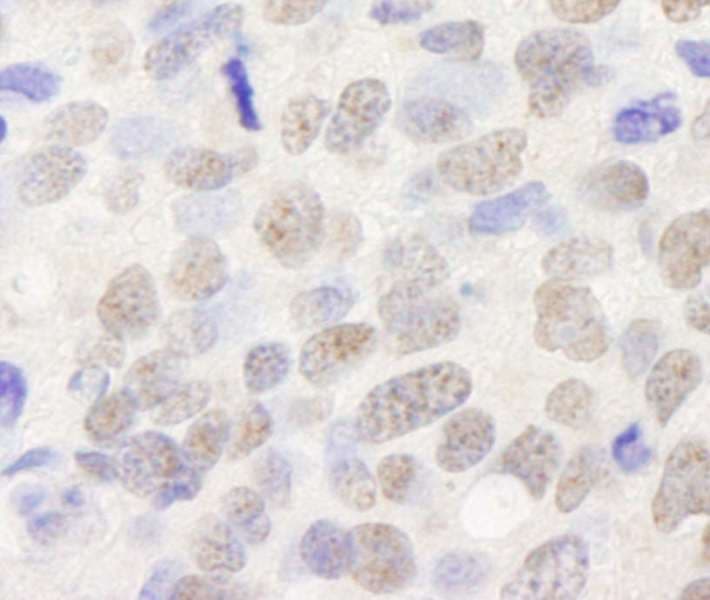 TRIM24 / TIF1 Antibody (aa700-750)