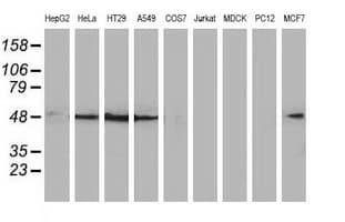 SQSTM1 Antibody (clone OTI6A7)