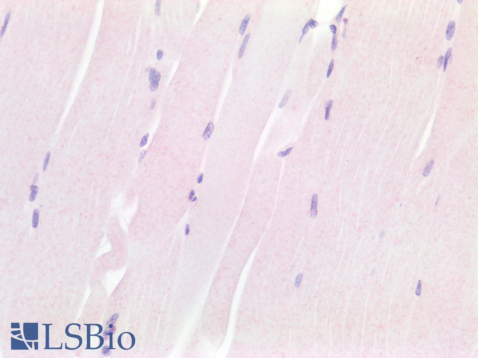 IHC-plus™ Polyclonal Rabbit anti-Human HPSE / Heparanase Antibody (IHC, WB)