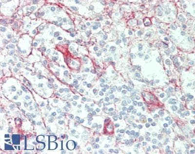 IHC-plus™ Polyclonal Rabbit anti-Human COL4A2 / Collagen IV Alpha2 Antibody (aa156-186, IHC, WB)