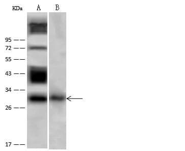 HNE / Neutrophil Elastase Antibody (Preservative Free)