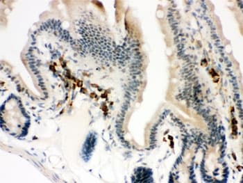 Polyclonal Rabbit anti-Human ACTA1 / Skeletal Muscle Actin Antibody (IHC, WB)