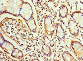 SRI / Sorcin Antibody (aa1-198)