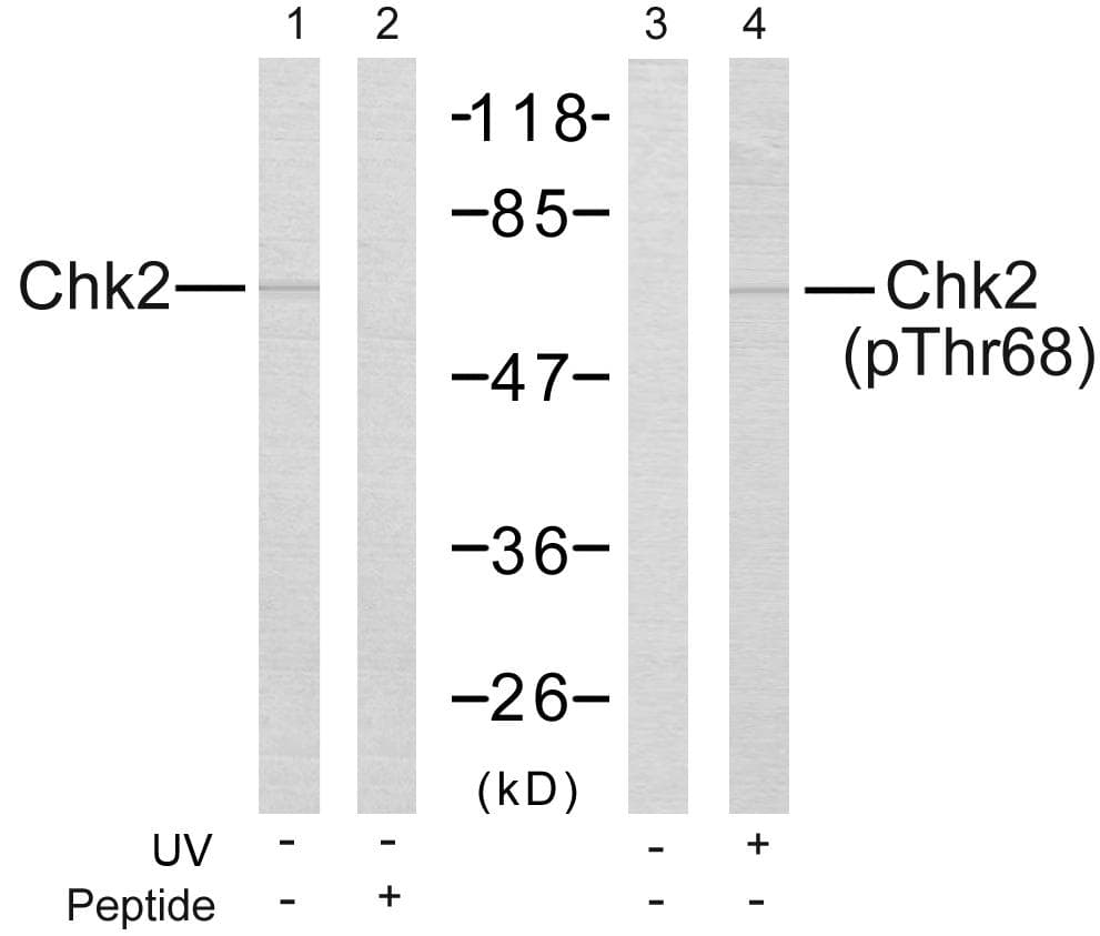 CHEK2 / CHK2 Antibody (phospho-Thr68)