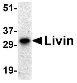 Polyclonal Rabbit anti-Human BIRC7 / Livin Antibody (aa264-280, IHC, WB)