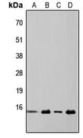 EIF4EBP1 / 4EBP1 Antibody (Internal)