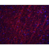 IHC-plus™ PACS2 Antibody