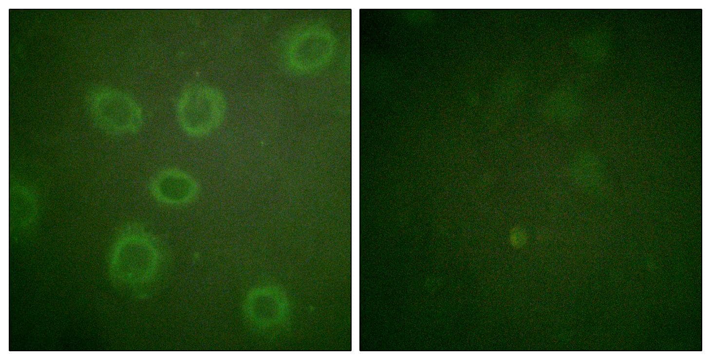 ERBB2 / HER2 Antibody (phospho-Thr686)