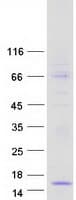 Human PTH2 / Parathyroid Hormone 2 Protein (Recombinant Myc-DDK (Flag))