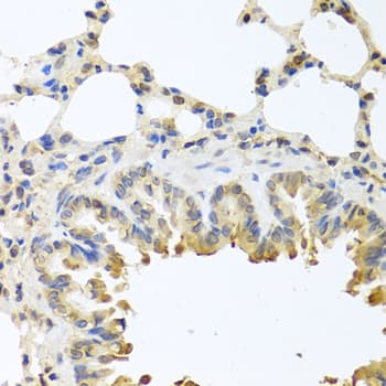 Polyclonal Rabbit anti-Human BAX Antibody (IHC, IF, WB)