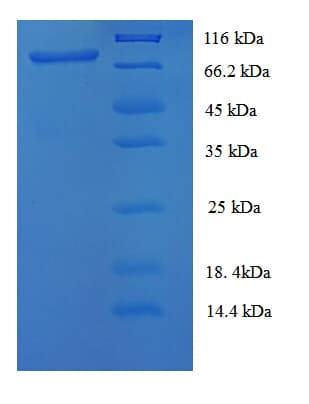 Cynomolgus monkey ALB / Serum Albumin Protein (Recombinant His-SUMO)