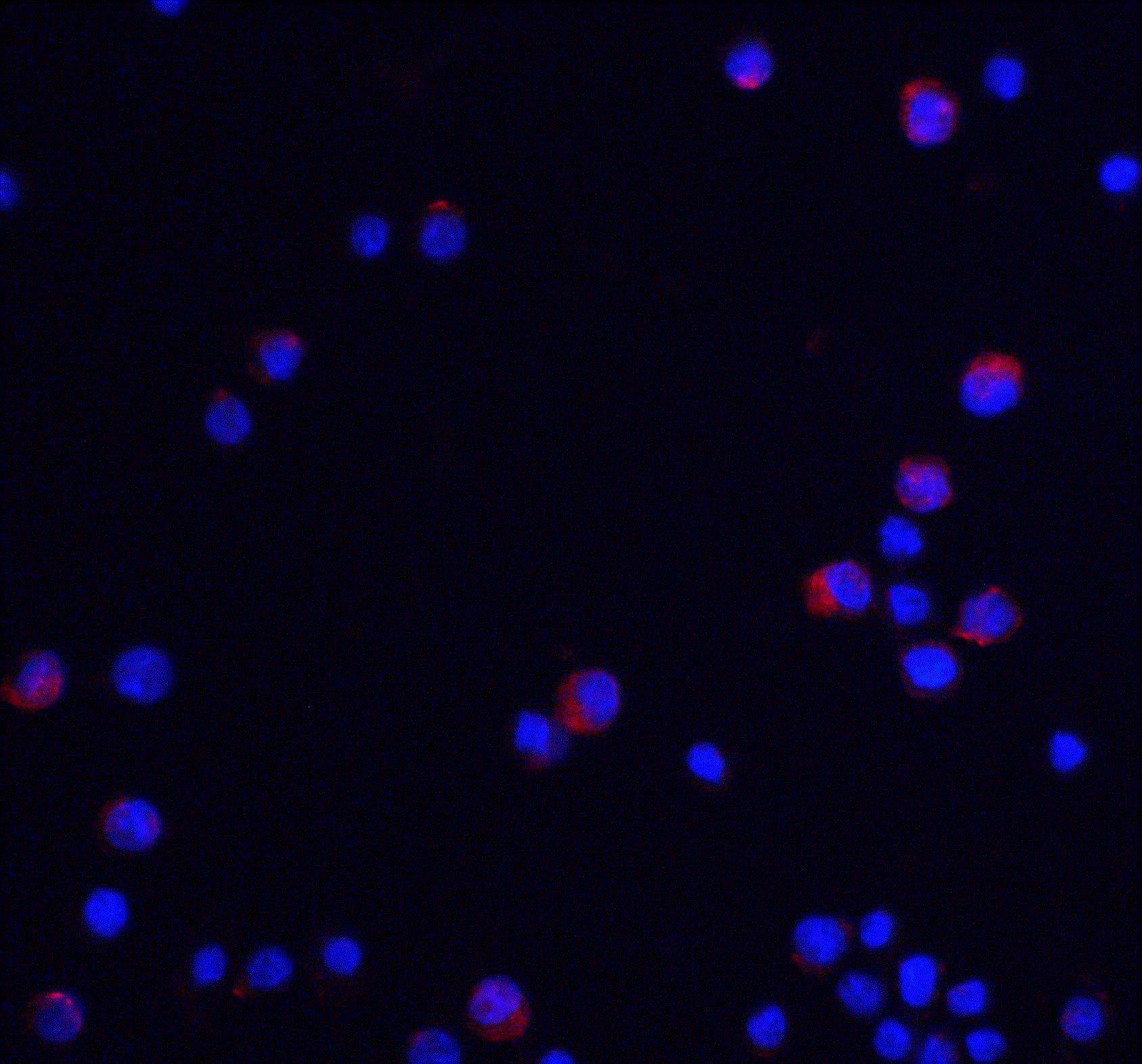 IHC-plus™ UBAP2L Antibody