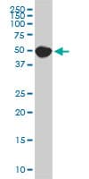 Monoclonal Mouse anti-Human ATL1 Antibody (clone 1B11, WB)