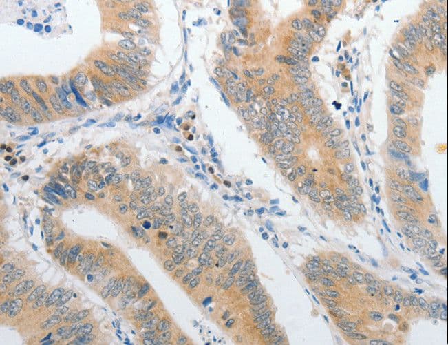 PIBF1 / PIBF Antibody