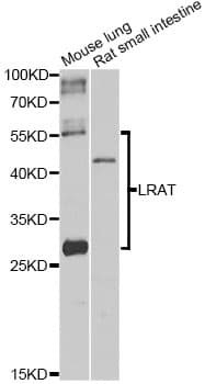 LRAT Antibody