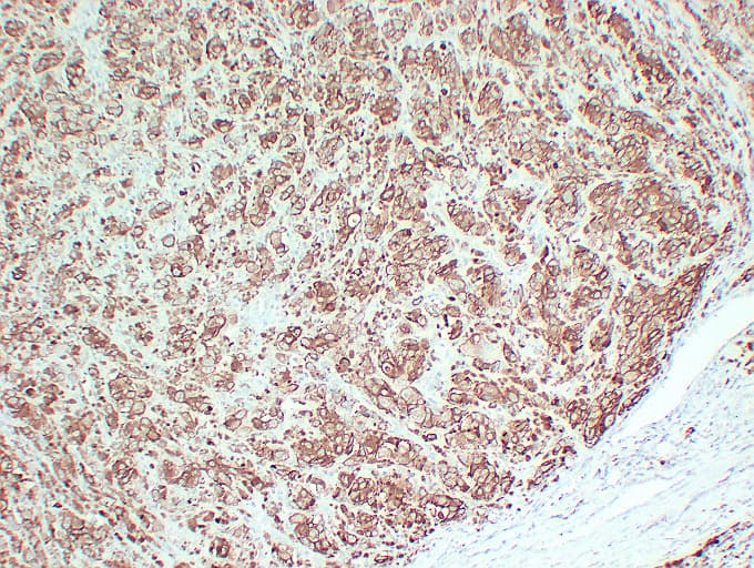 Monoclonal Mouse anti-Human Tyrosinase Antibody (clone ABT-TYR, IHC)