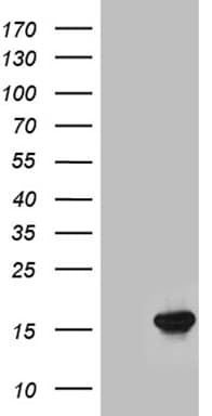 LGALS1 / Galectin 1 Antibody (clone OTI1E2)