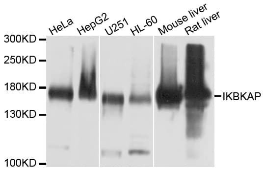 Polyclonal Rabbit anti-Human IKBKAP / IKAP Antibody (WB)