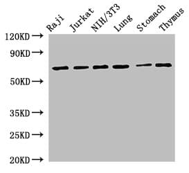 Polyclonal Rabbit anti-Human FOXN1 Antibody (IHC, WB)
